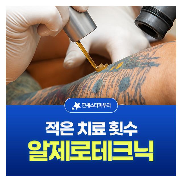 적은 치료 횟수 알제로테크닉 피부 손상을 최소화