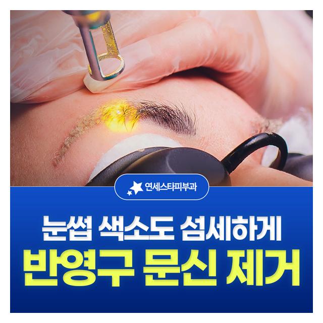 반영구 문신 제거, 눈썹 색소도 섬세하게 제거할 수 있습니다