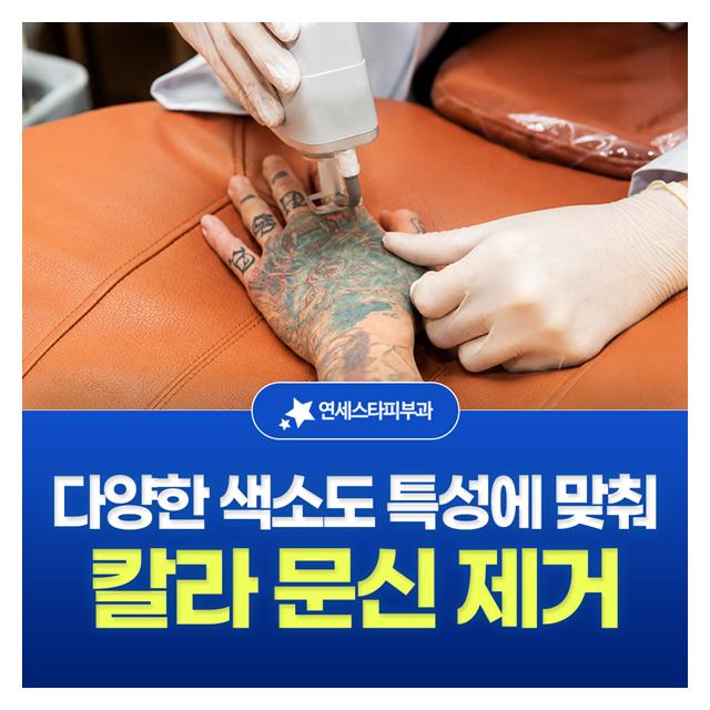 칼라 문신 제거, 다양한 색소도 특성에 맞춰 시술합니다
